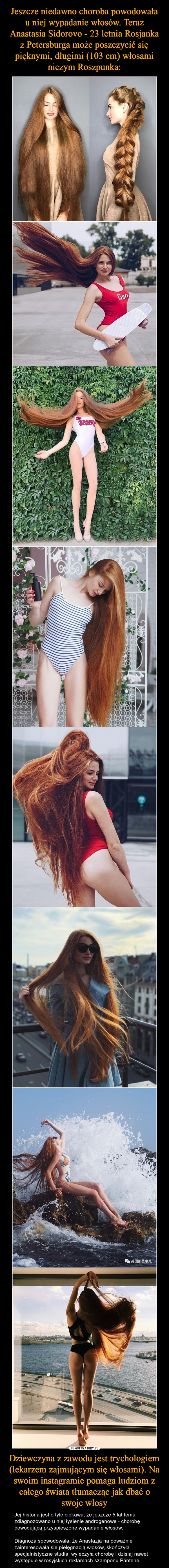 Jeszcze niedawno choroba powodowała u niej wypadanie włosów. Teraz Anastasia Sidorovo - 23 letnia Rosjanka z Petersburga może poszczycić się pięknymi, długimi (103 cm) włosami niczym Roszpunka: Dziewczyna z zawodu jest trychologiem (lekarzem zajmującym się włosami). Na swoim instagramie pomaga ludziom z całego świata tłumacząc jak dbać o swoje włosy