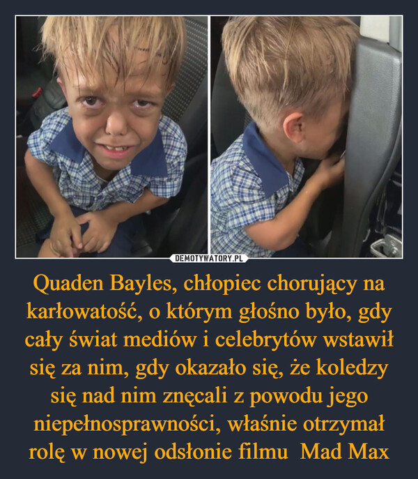 Quaden Bayles, chłopiec chorujący na karłowatość, o którym głośno było, gdy cały świat mediów i celebrytów wstawił się za nim, gdy okazało się, że koledzy się nad nim znęcali z powodu jego niepełnosprawności, właśnie otrzymał rolę w nowej odsłonie filmu  Mad Max –  