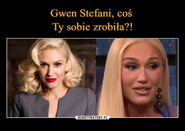 Gwen Stefani, coś 
Ty sobie zrobiła?!