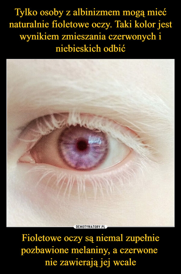 Fioletowe oczy są niemal zupełnie pozbawione melaniny, a czerwone nie zawierają jej wcale –  M